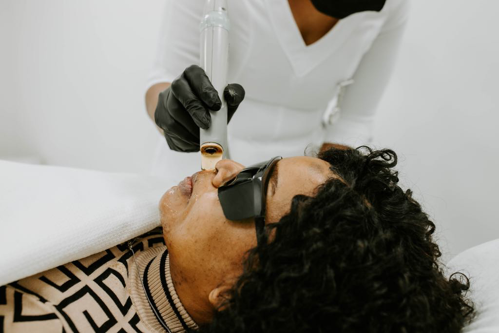 laser hair removal